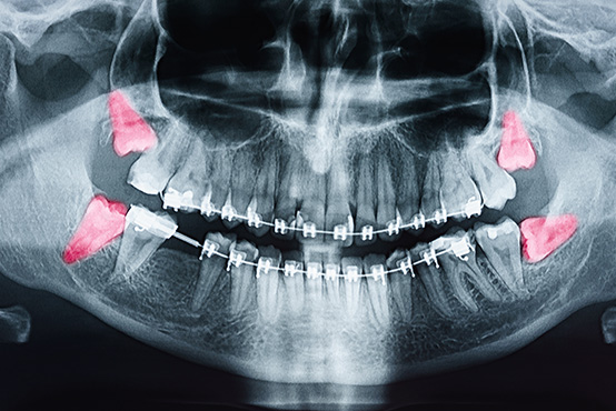 Southern Connecticut Oral Maxillofacial Surgery Implantology