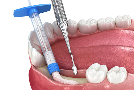 Southern Connecticut Oral Maxillofacial Surgery Implantology